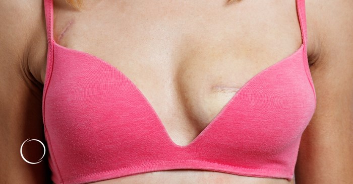 understanding your reconstructive options after breast cancer