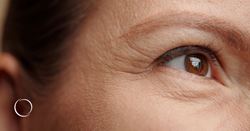 Surgical options for hooded eyes: Minimal to dramatic