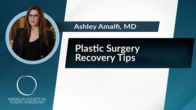 Plastic Surgery Recovery Tips
