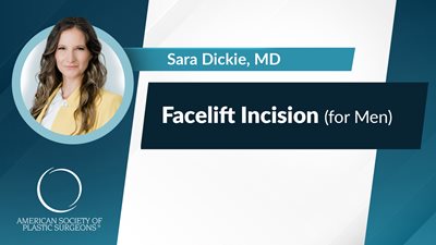 Facelift Incision for Men