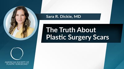 The Truth About Plastic Surgery Scars