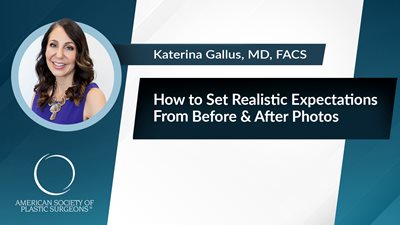 How to Set Realistic Expectations From Before & After Photos
